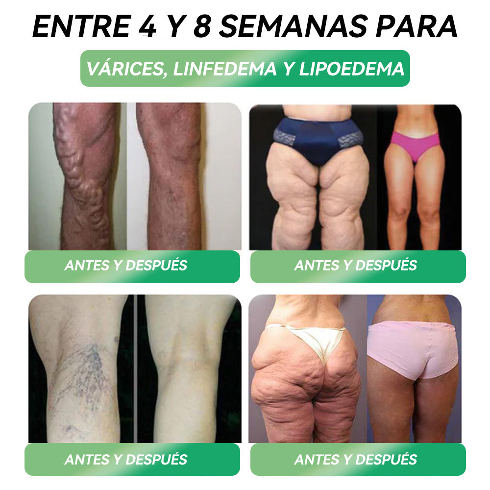 Tienda Oficial | HHVB®💖GLP-1 Solución Oral de Salud SEIS-EN-UNO (Solo una vez al día, cambios visibles en 7 días) ✅ Para la obesidad, la salud del corazón, la diabetes, la apnea del sueño, la salud intestinal, problemas en las articulaciones y más.